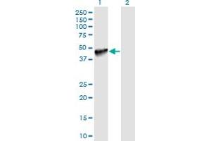 Western Blot analysis of PDCD1LG2 expression in transfected 293T cell line by PDCD1LG2 monoclonal antibody (M06), clone 7D5.