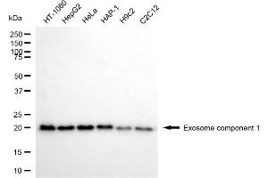 Western blotting analysis using exosome component 1 antibody (ABIN7798545). (EXOSC1 antibody)