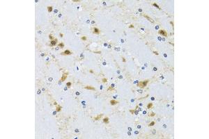 Immunohistochemistry of paraffin-embedded mouse brain using CCT4 antibody (ABIN2561655) at dilution of 1:100 (40x lens). (CCT4 antibody)