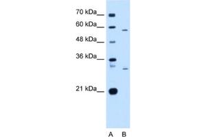 Western Blotting (WB) image for anti-CD36 (CD36) antibody (ABIN2463133) (CD36 antibody)