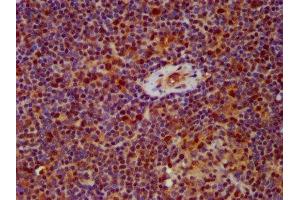 Immunohistochemistry (IHC) image for anti-Heterogeneous Nuclear Ribonucleoprotein A/B (HNRNPAB) (AA 1-68) antibody (ABIN7155093)