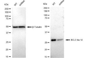 anti-BCL2-Like 12 (Proline Rich) (BCL2L12) antibody