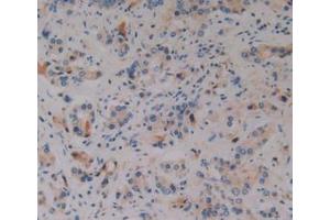 Immunohistochemistry (IHC) image for anti-Prothrombin Fragment 1+2 (F1+2) (AA 44-327) antibody (ABIN1173462)