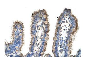 Image no. 1 for anti-rho-Related BTB Domain Containing 1 (RHOBTB1) (C-Term) antibody (ABIN6736347) (RHOBTB1 antibody  (C-Term))