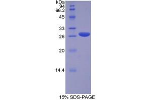 SDS-PAGE analysis of Human RUNX2 Protein. (RUNX2 Protein)