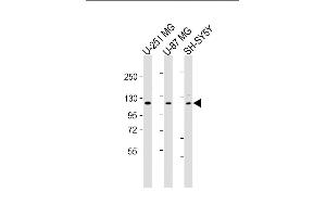 All lanes : Anti-SH3PXD2B Antibody (C-Term) at 1:2000 dilution Lane 1: U-251 MG whole cell lysate Lane 2: U-87 MG whole cell lysate Lane 3: SH-SY5Y whole cell lysate Lysates/proteins at 20 μg per lane.