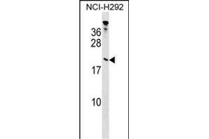 TP Antibody (Center) (ABIN1538440 and ABIN2848728) western blot analysis in NCI- cell line lysates (35 μg/lane). (Tppp antibody  (AA 47-75))