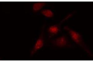 ABIN6274188 staining HT29 cells by IF/ICC. (AFT1 antibody  (Internal Region))