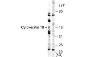 Western blot analysis of extracts from HuvEc cells, using Keratin 18 (Ab-52) Antibody. (Cytokeratin 18 antibody  (AA 21-70))