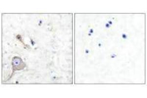 Immunohistochemical analysis of paraffin-embedded human brain tissue using S100 A1 antibody. (S1A1 antibody)