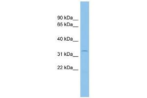 ACP5 antibody used at 1 ug/ml to detect target protein. (ACP5 antibody  (N-Term))
