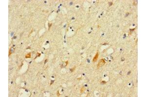 Immunohistochemistry of paraffin-embedded human brain tissue using ABIN7156163 at dilution of 1:100 (PLCL2 antibody  (AA 2-300))