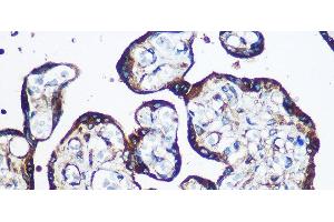 Immunohistochemistry of paraffin-embedded Human placenta using YTHDF2 Polyclonal Antibody at dilution of 1:100 (40x lens). (YTHDF2 antibody)