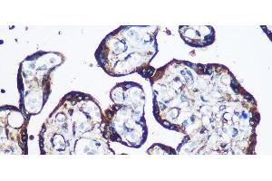 Immunohistochemistry of paraffin-embedded Human placenta using YTHDF2 Polyclonal Antibody at dilution of 1:100 (40x lens).
