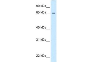 Primary Retinal Dysplasia (PRD) antibody