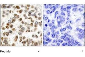 Image no. 1 for anti-Breast Cancer 1 (BRCA1) (Ser1423) antibody (ABIN197480) (BRCA1 antibody  (Ser1423))