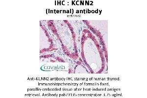 Image no. 2 for anti-Potassium Intermediate/small Conductance Calcium-Activated Channel, Subfamily N, Member 2 (KCNN2) (AA 545-557), (Internal Region) antibody (ABIN1736194) (KCNN2 antibody  (Internal Region))
