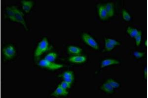 Immunofluorescent analysis of Hela cells using ABIN7143299 at dilution of 1:100 and Alexa Fluor 488-congugated AffiniPure Goat Anti-Rabbit IgG(H+L) (ADORA1 antibody  (AA 202-235))