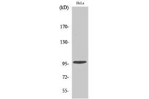 Western Blotting (WB) image for anti-Checkpoint Kinase 2 (CHEK2) (pThr68) antibody (ABIN5961583) (CHEK2 antibody  (pThr68))
