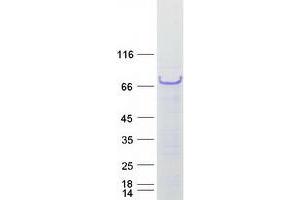 Validation with Western Blot