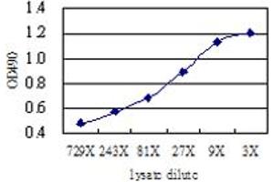 ACY1 (Human) Matched Antibody Pair