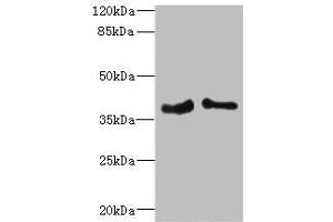 Western blot All lanes: PHF11 antibody at 4. (PHF11 antibody  (AA 1-292))