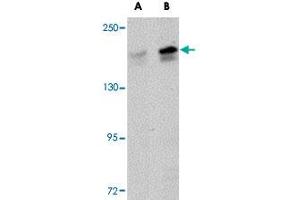 Western blot analysis of PALB2 in SK-N-SH cell lysate with PALB2 polyclonal antibody  at (A) 1 and (B) 2 ug/mL . (PALB2 antibody  (C-Term))