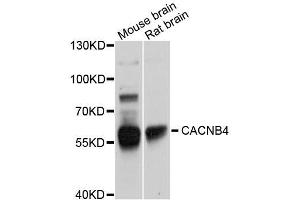 Western blot analysis of extracts of various cell lines, using CACNB4 antibody (ABIN5996096) at 1/1000 dilution. (CACNB4 antibody)