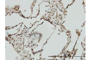 Immunoperoxidase of monoclonal antibody to BIK on formalin-fixed paraffin-embedded human lung. (BIK antibody  (AA 37-136))