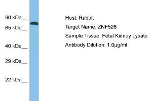 Host: Rabbit Target Name: ZNF526 Sample Type: Fetal Kidney lysates Antibody Dilution: 1.