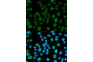 Immunofluorescence analysis of HeLa cells using EMD antibody. (Emerin antibody  (AA 1-220))