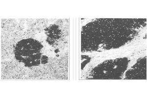 Image no. 1 for anti-Enolase 2 (Gamma, Neuronal) (ENO2) antibody (ABIN211314) (ENO2/NSE antibody)