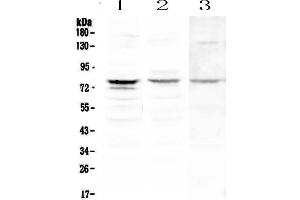 Western blot analysis of PLK2 using anti-PLK2 antibody . (PLK2 antibody  (AA 94-188))