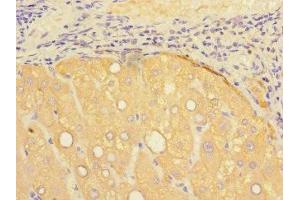 Immunohistochemistry of paraffin-embedded human liver tissue using ABIN7164264 at dilution of 1:100 (Presenilin 1 antibody  (AA 4-218))