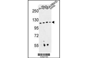 Western blot analysis of RPGRIP1 Antibody in HL-60, K562, MDA-MB435, Jurkat cell line lysates (35ug/lane) (RPGRIP1 antibody  (AA 530-557))
