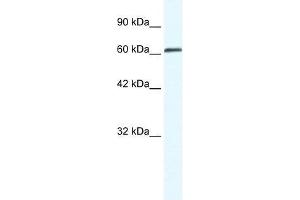 ZMYM6 antibody  (Middle Region)