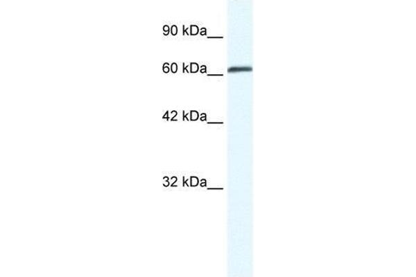 ZMYM6 antibody  (Middle Region)
