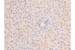 Immunohistochemistry (IHC) image for anti-Tumor Protein P53 (TP53) (pSer15) antibody (ABIN6256151)