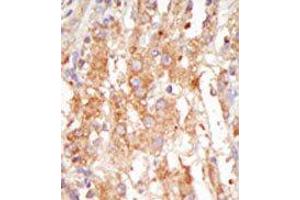 Image no. 2 for anti-Mitogen-Activated Protein Kinase Kinase Kinase 6 (MAP3K6) (C-Term) antibody (ABIN360297) (MAP3K6 antibody  (C-Term))