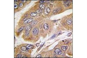 Image no. 1 for anti-Ribosomal Protein S6 Kinase, 70kDa, Polypeptide 1 (RPS6KB1) (Ser424) antibody (ABIN5552136)