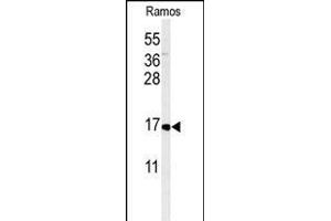 Western blot analysis of CMTM7 Antibody (N-term) (ABIN651213 and ABIN2840134) in Ramos cell line lysates (35 μg/lane). (CMTM7 antibody  (N-Term))