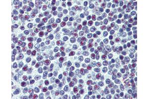 anti-Upstream Binding Transcription Factor, RNA Polymerase I (UBTF) (AA 551-651) antibody