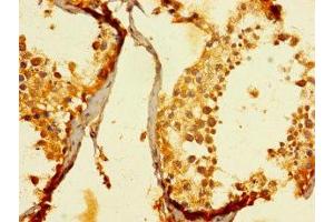 Immunohistochemistry of paraffin-embedded human testis tissue using ABIN7151372 at dilution of 1:100 (ENTPD3 antibody  (AA 60-338))