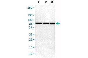 Western Blot analysis of Lane 1: NIH-3T3 cell lysate (mouse embryonic fibroblast cells), Lane 2: NBT-II cell lysate (Wistar rat bladder tumor cells) and Lane 3: PC12 cell lysate (pheochromocytoma of rat adrenal medulla) with PRKAG2 polyclonal antibody . (PRKAG2 antibody)