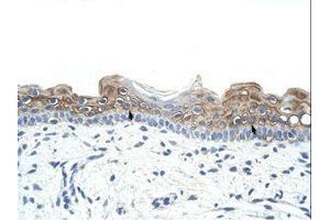 Image no. 1 for anti-Deleted in Azoospermia 2 (DAZ2) (AA 51-100) antibody (ABIN6736260) (DAZ2 antibody  (AA 51-100))