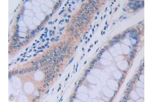 Used in DAB staining on fromalin fixed paraffin- embedded liver tissue (RNASE13 antibody  (AA 20-156))