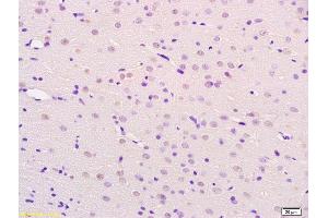 Formalin-fixed and paraffin embedded rat brain labeled with Anti-BCHE Polyclonal Antibody, Unconjugated (ABIN730603) at 1:200 followed by conjugation to the secondary antibody and DAB staining. (Butyrylcholinesterase antibody  (AA 505-602))