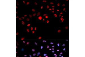 Immunofluorescence analysis of MCF-7 cells using Phospho-CREB1(S133) Polyclonal Antibody (CREB1 antibody  (pSer133))