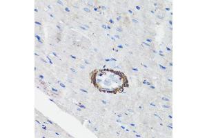 Immunohistochemistry of paraffin-embedded rat heart using Filamin A antibody (ABIN7267206) at dilution of 1:100 (40x lens). (Filamin A antibody  (C-Term))