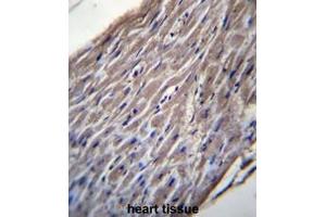 BVES Antibody (C-term) immunohistochemistry analysis in formalin fixed and paraffin embedded human heart tissue followed by peroxidase conjugation of the secondary antibody and DAB staining. (BVES antibody  (C-Term))